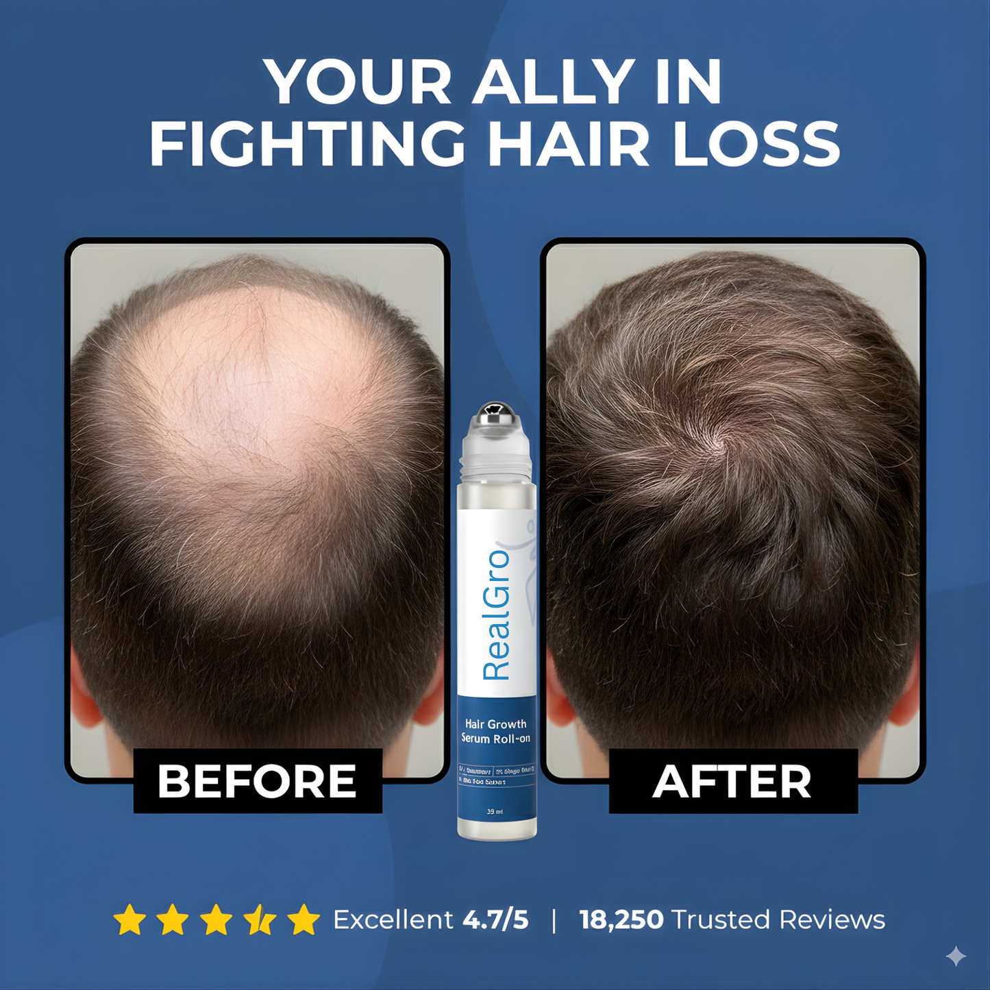 RealGro™ Hair Growth Roll on Serum