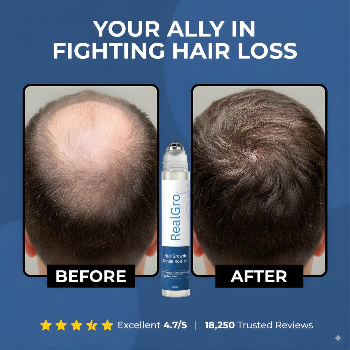 RealGro™ Hair Growth Roll on Serum