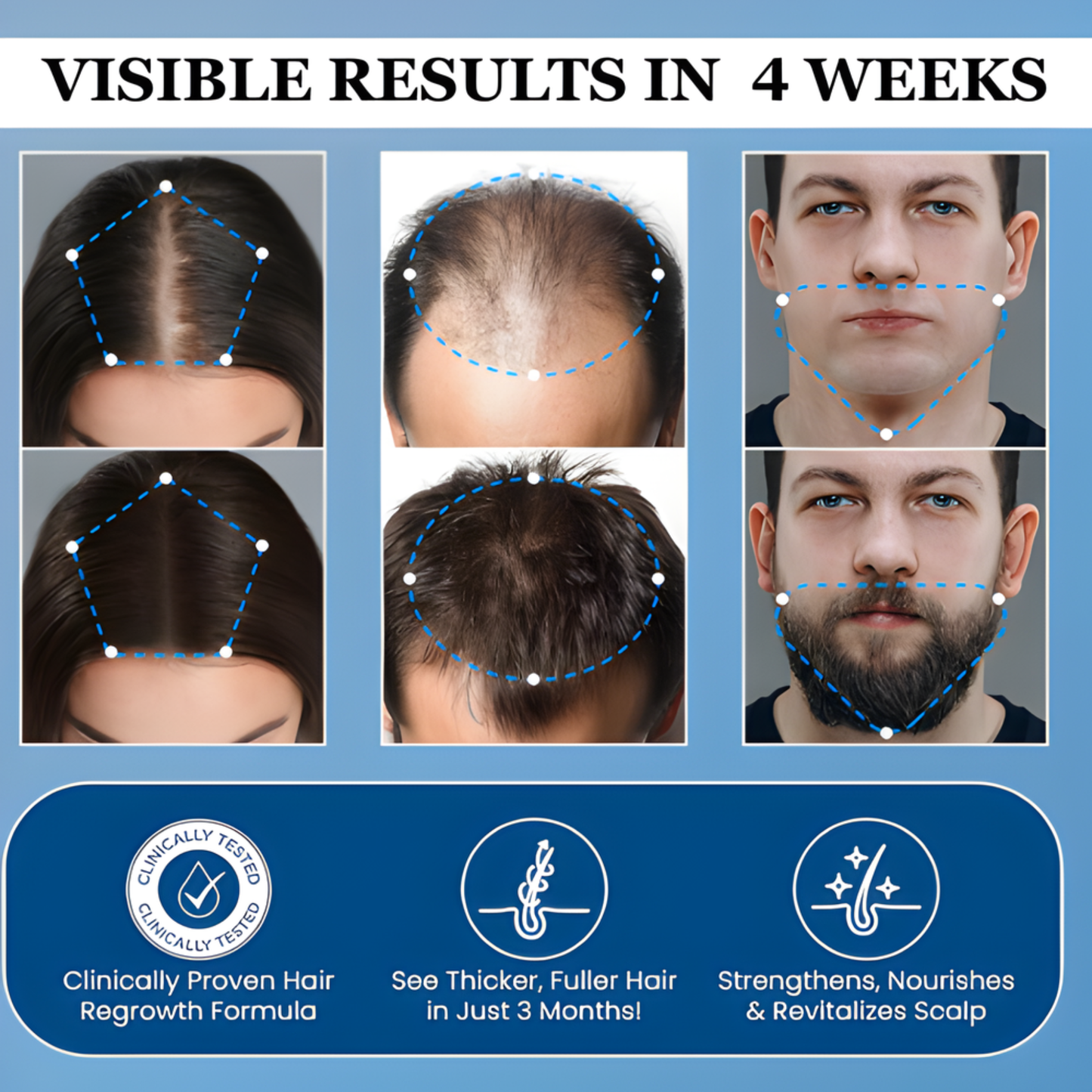 RealGro™ Hair Growth Roll on Serum