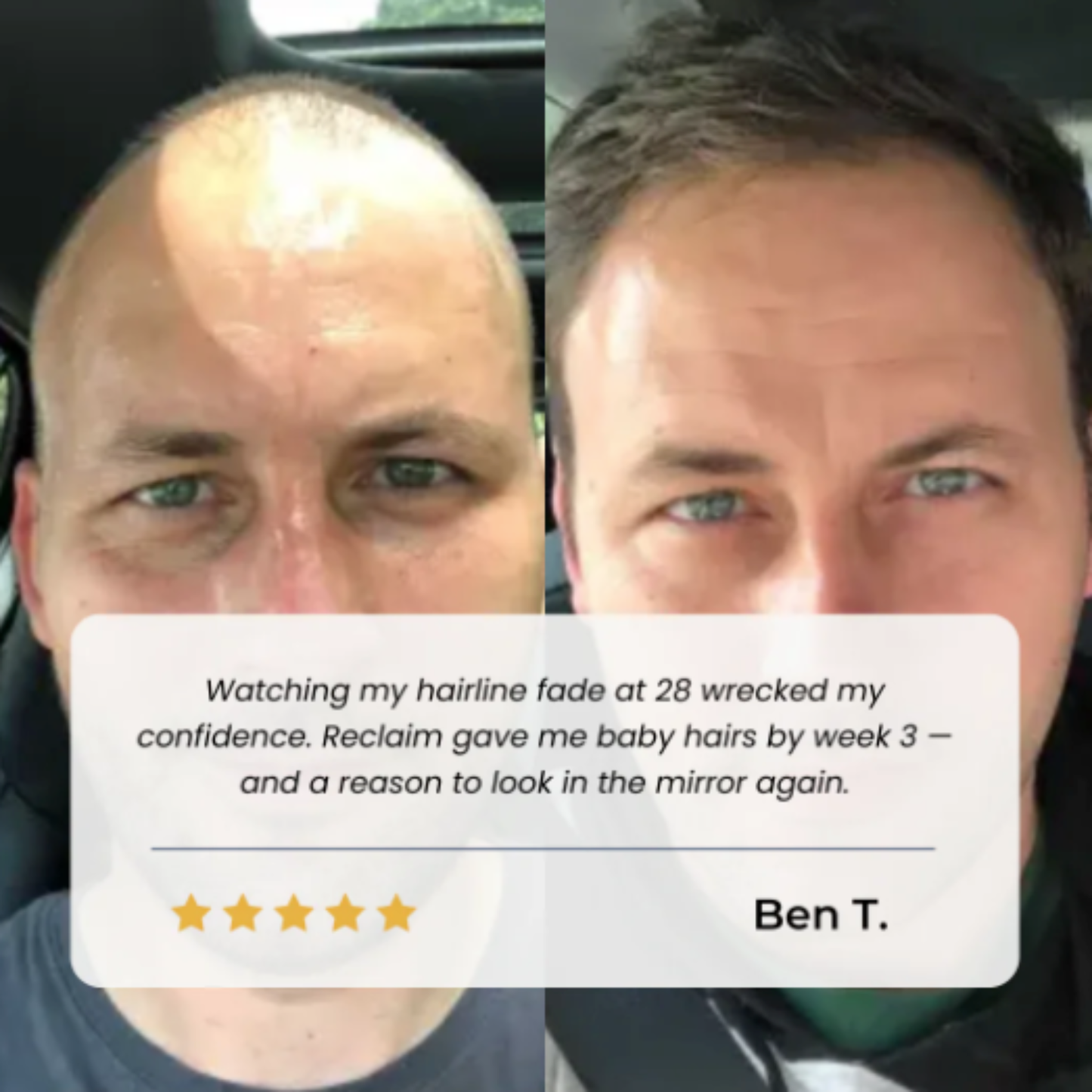 RealGro™ Hair Growth Roll on Serum